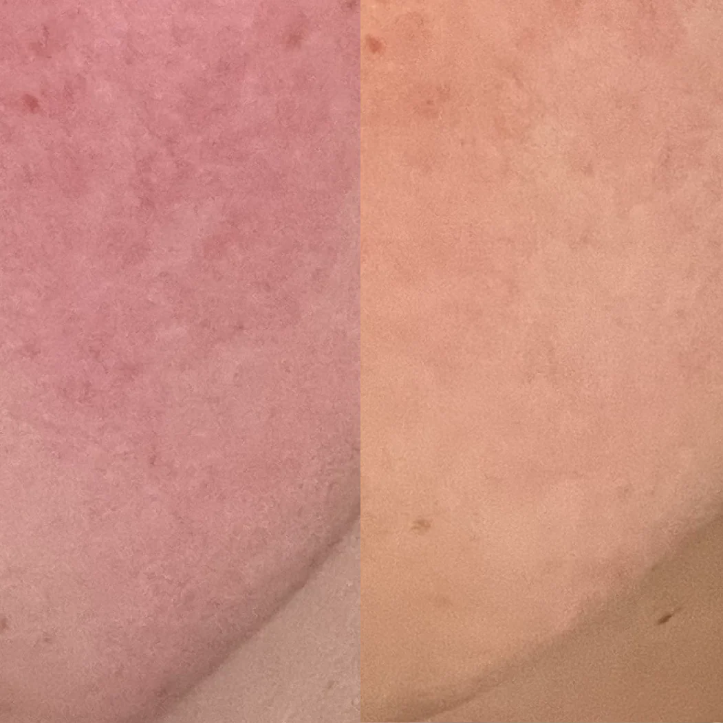 Reflektskincare: Embrace Your Skin's True Radiance