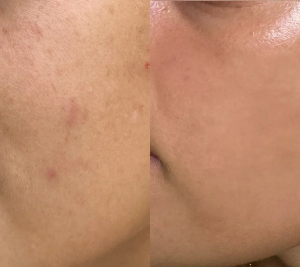 Reflektskincare: Embrace Your Skin's True Radiance