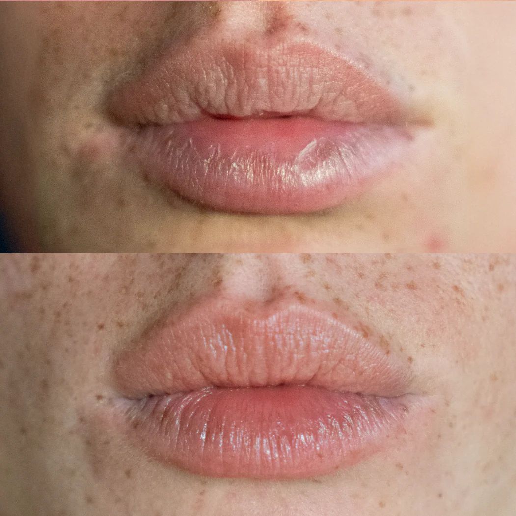 Reflektskincare: Embrace Your Skin's True Radiance